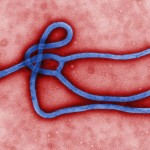エボラウイルス