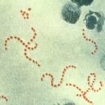 化膿レンサ球菌